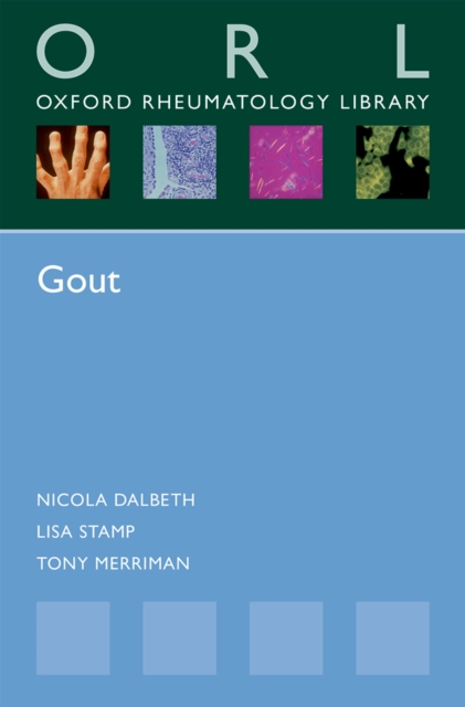 Gout, EPUB eBook