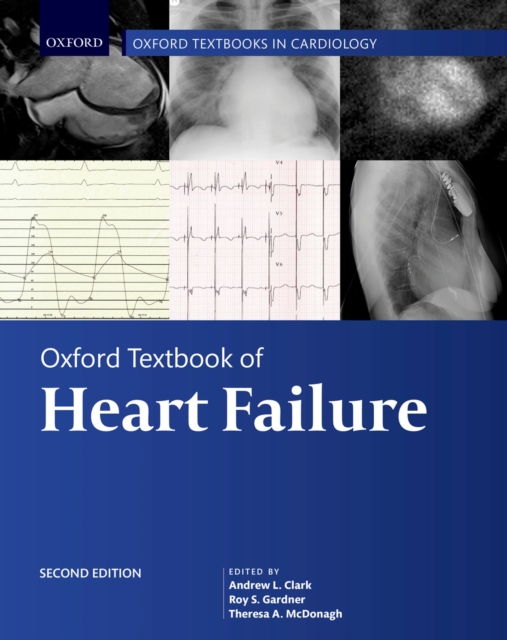 Oxford Textbook of Heart Failure, PDF eBook