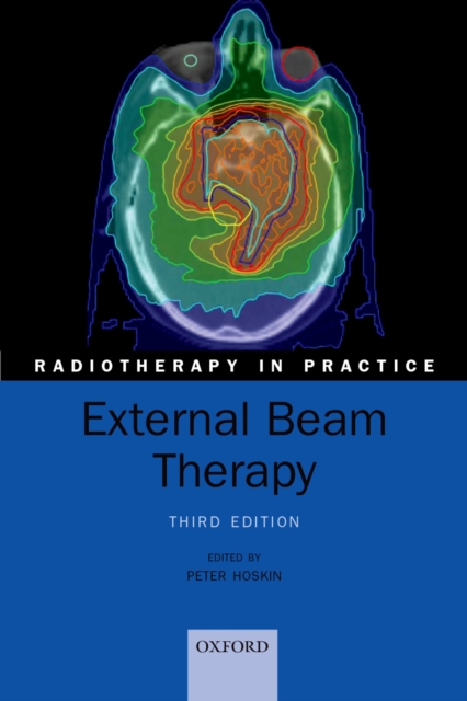 External Beam Therapy, EPUB eBook