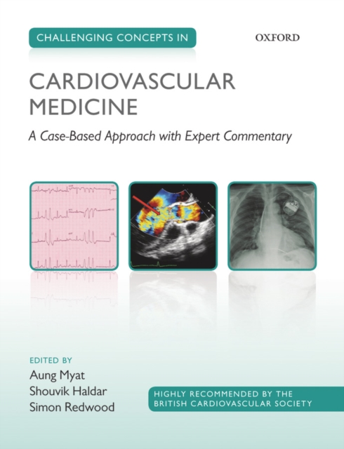 Challenging Concepts in Cardiovascular Medicine : A Case-Based Approach with Expert Commentary, PDF eBook
