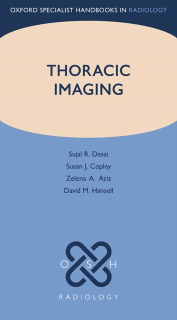 Thoracic Imaging, EPUB eBook