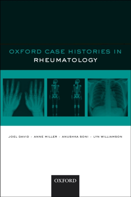 Oxford Case Histories in Rheumatology, PDF eBook