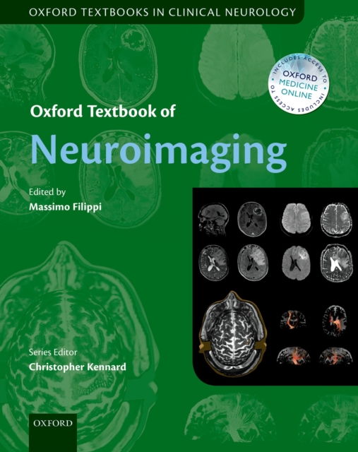 Oxford Textbook of Neuroimaging, PDF eBook