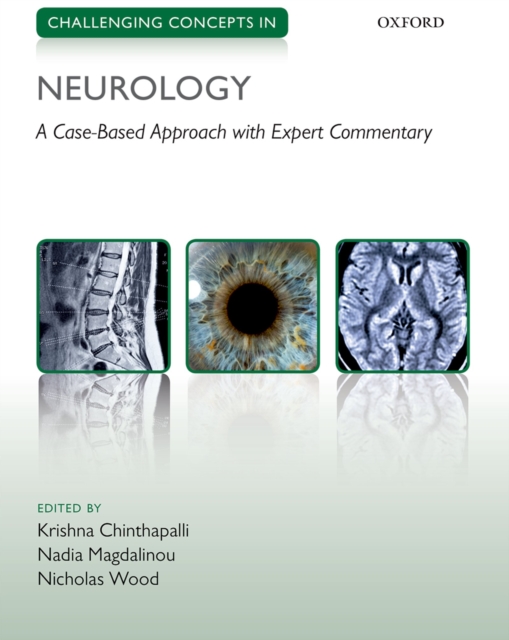 Challenging Concepts in Neurology : Cases with Expert Commentary, PDF eBook