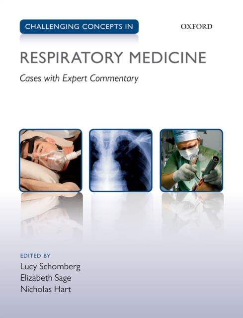 Challenging Concepts in Respiratory Medicine : Cases with Expert Commentary, PDF eBook