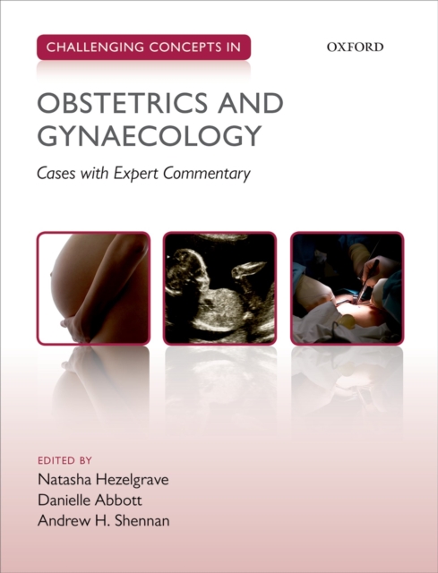 Challenging Concepts in Obstetrics and Gynaecology : Cases with Expert Commentary, PDF eBook