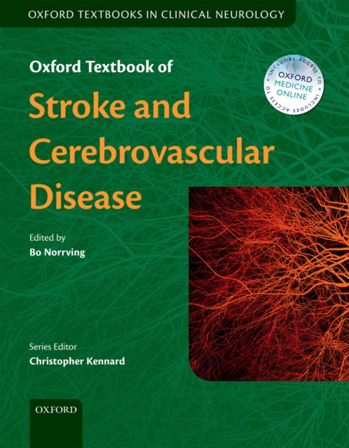 Oxford Textbook of Stroke and Cerebrovascular Disease, PDF eBook