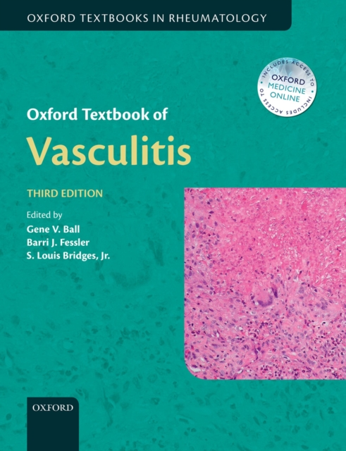 Oxford Textbook of Vasculitis, PDF eBook