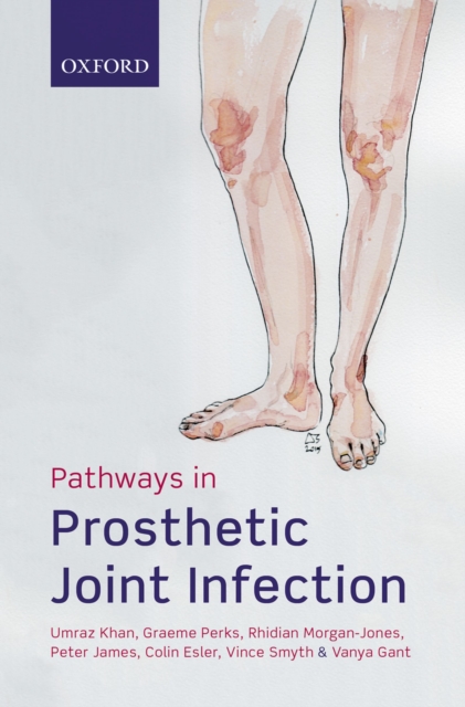 Pathways in Prosthetic Joint Infection, PDF eBook
