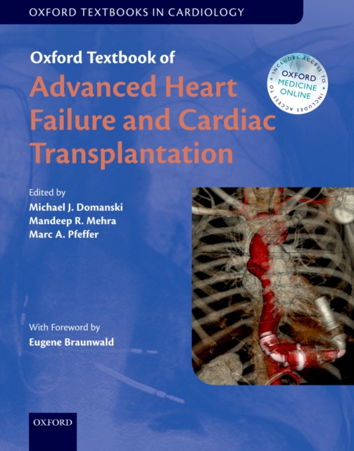 Oxford Textbook of Advanced Heart Failure and Cardiac Transplantation, EPUB eBook