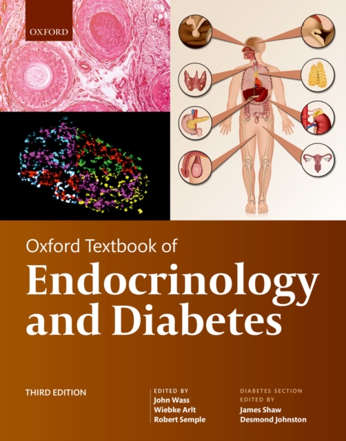 Oxford Textbook of Endocrinology and Diabetes, PDF eBook