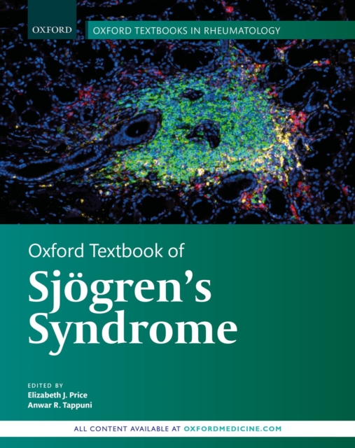 Oxford Textbook of Sjogren's Syndrome, PDF eBook