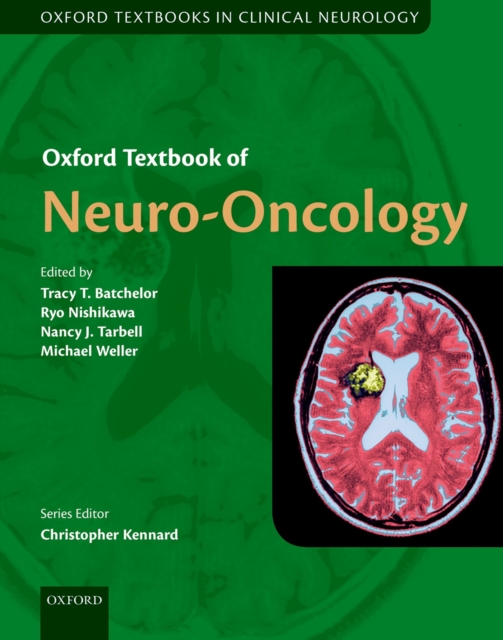 Oxford Textbook of Neuro-Oncology, EPUB eBook
