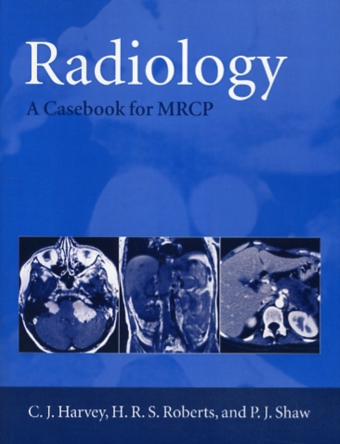 Radiology : A Case-book for MRCP, Paperback / softback Book