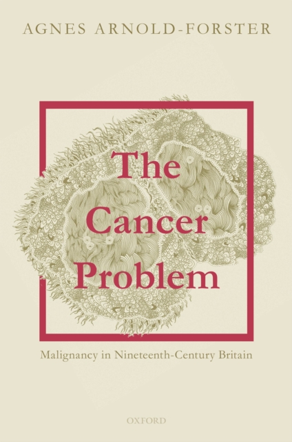 The Cancer Problem : Malignancy in Nineteenth-Century Britain, EPUB eBook
