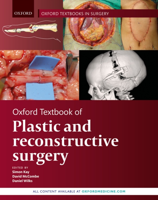 Oxford Textbook of Plastic and Reconstructive Surgery, EPUB eBook