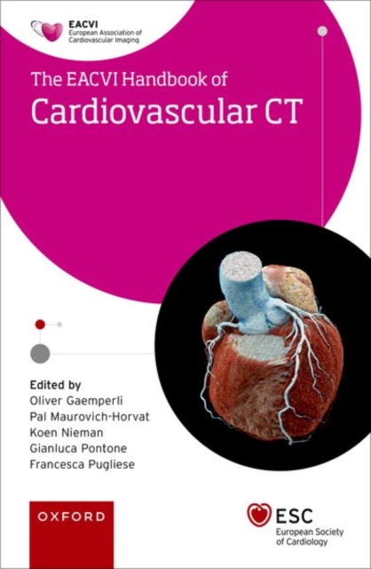 EACVI Handbook of Cardiovascular CT, Paperback / softback Book