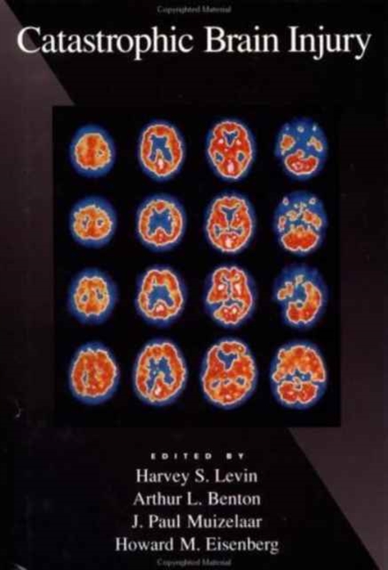 Catastrophic Brain Injury, Hardback Book