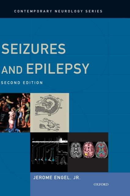 Seizures and Epilepsy, Hardback Book