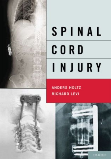 Spinal Cord Injury, Hardback Book
