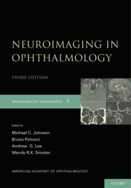 Neuroimaging in Ophthalmology, Hardback Book