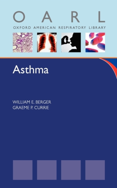 Asthma, Paperback / softback Book