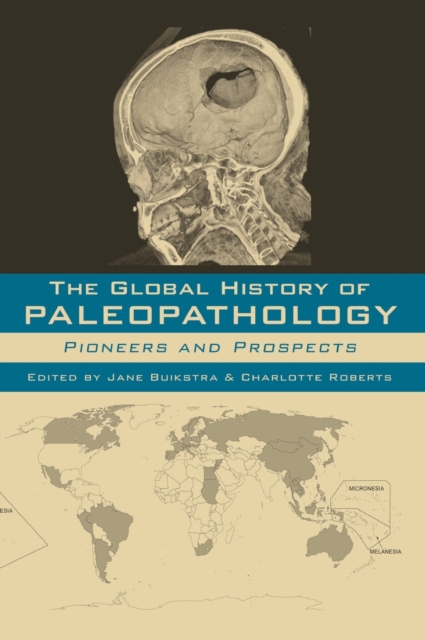 The Global History of Paleopathology : Pioneers and Prospects, Hardback Book