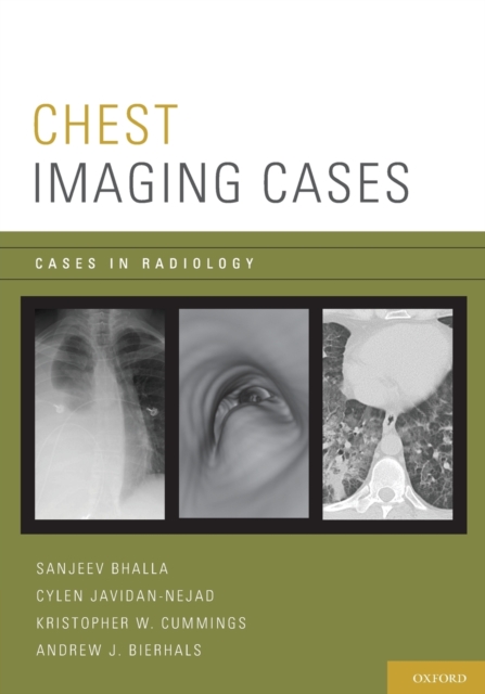 Chest Imaging Cases, Paperback / softback Book