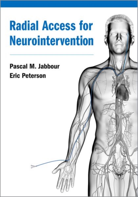 Radial Access for Neurointervention, Hardback Book