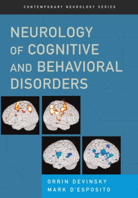 Neurology of Cognitive and Behavioral Disorders, PDF eBook