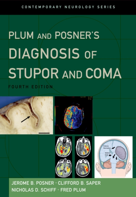 Plum and Posner's Diagnosis of Stupor and Coma, PDF eBook