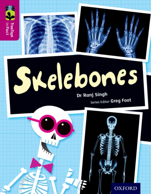 Oxford Reading Tree TreeTops inFact: Level 10: Skelebones, Paperback / softback Book