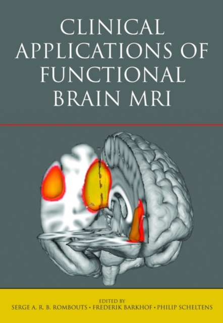 Clinical Applications of Functional Brain MRI, Hardback Book