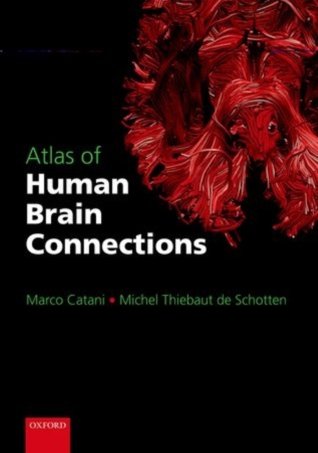 Atlas of Human Brain Connections, Paperback / softback Book