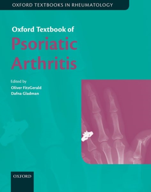Oxford Textbook of Psoriatic Arthritis, Hardback Book