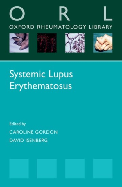 Systemic Lupus Erythematosus, Paperback / softback Book
