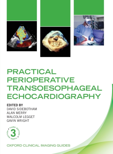 Practical Perioperative Transoesophageal Echocardiography, Paperback / softback Book