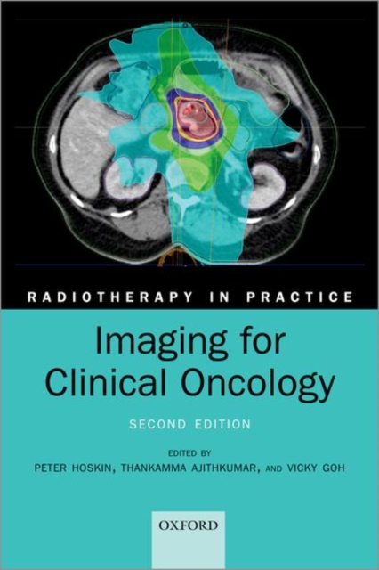 Imaging for Clinical Oncology, Paperback / softback Book