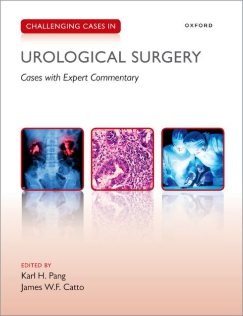 Challenging Cases in Urological Surgery, Paperback / softback Book