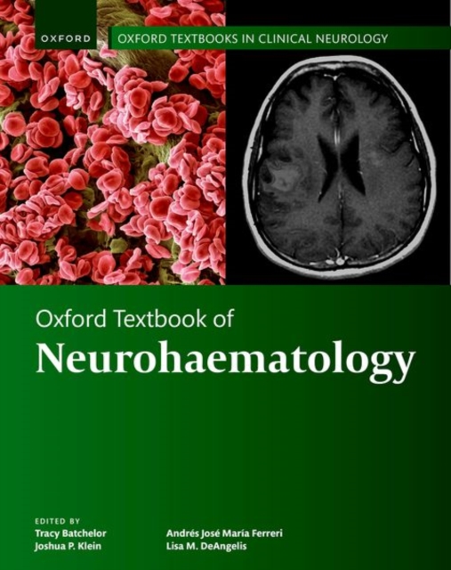 Oxford Textbook of Neurohaematology, Hardback Book