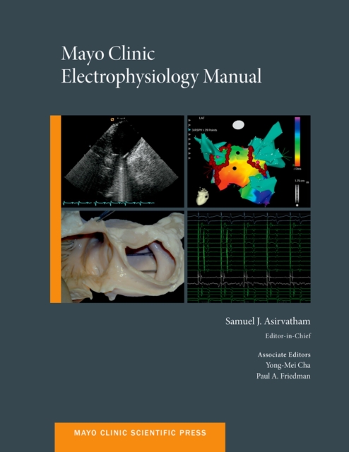 Mayo Clinic Electrophysiology Manual, PDF eBook