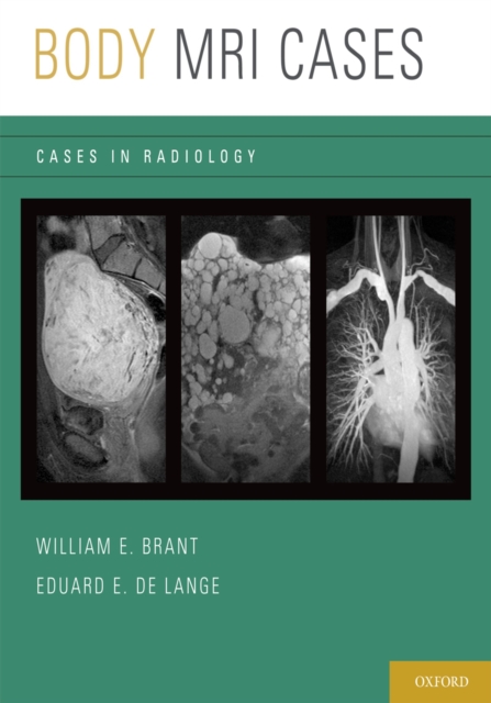 Body MRI Cases, PDF eBook