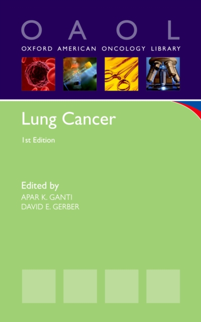 Lung Cancer, PDF eBook