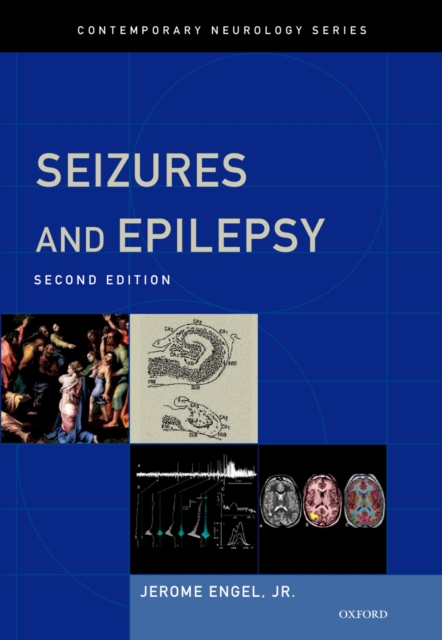 Seizures and Epilepsy, PDF eBook