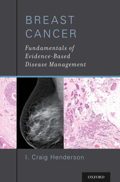 Breast Cancer : Fundamentals of Evidence-Based Disease Management, PDF eBook