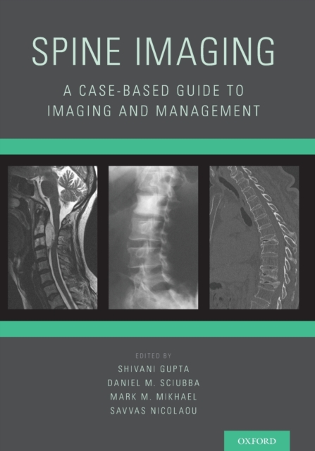 Spine Imaging : A Case-Based Guide to Imaging and Management, Paperback / softback Book