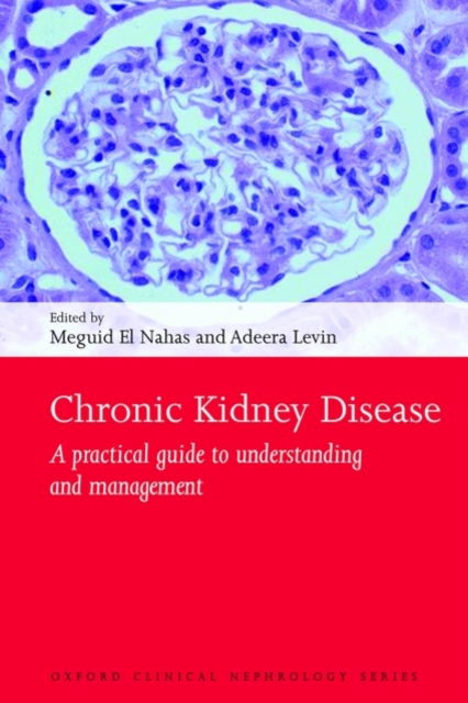 Chronic Kidney Disease : A practical guide to understanding and management, Paperback / softback Book