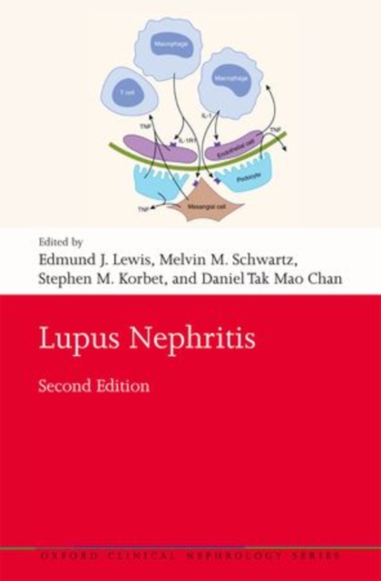 Lupus Nephritis, Paperback / softback Book