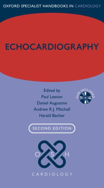 Echocardiography, Paperback / softback Book