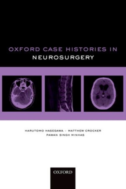 Oxford Case Histories in Neurosurgery, Paperback / softback Book